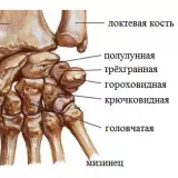 Возможно ли без врача, и как определить – ушиб или перелом запястья?